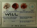 Blood-test-will.JPG